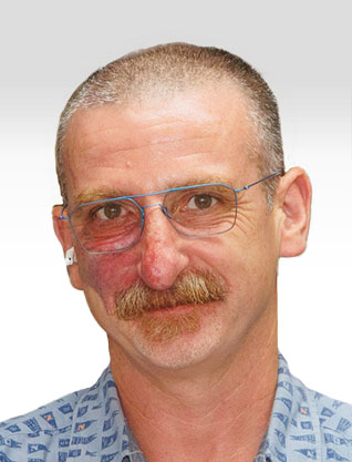 Alexei Rubitsky, Dr. Alexei Rubitsky